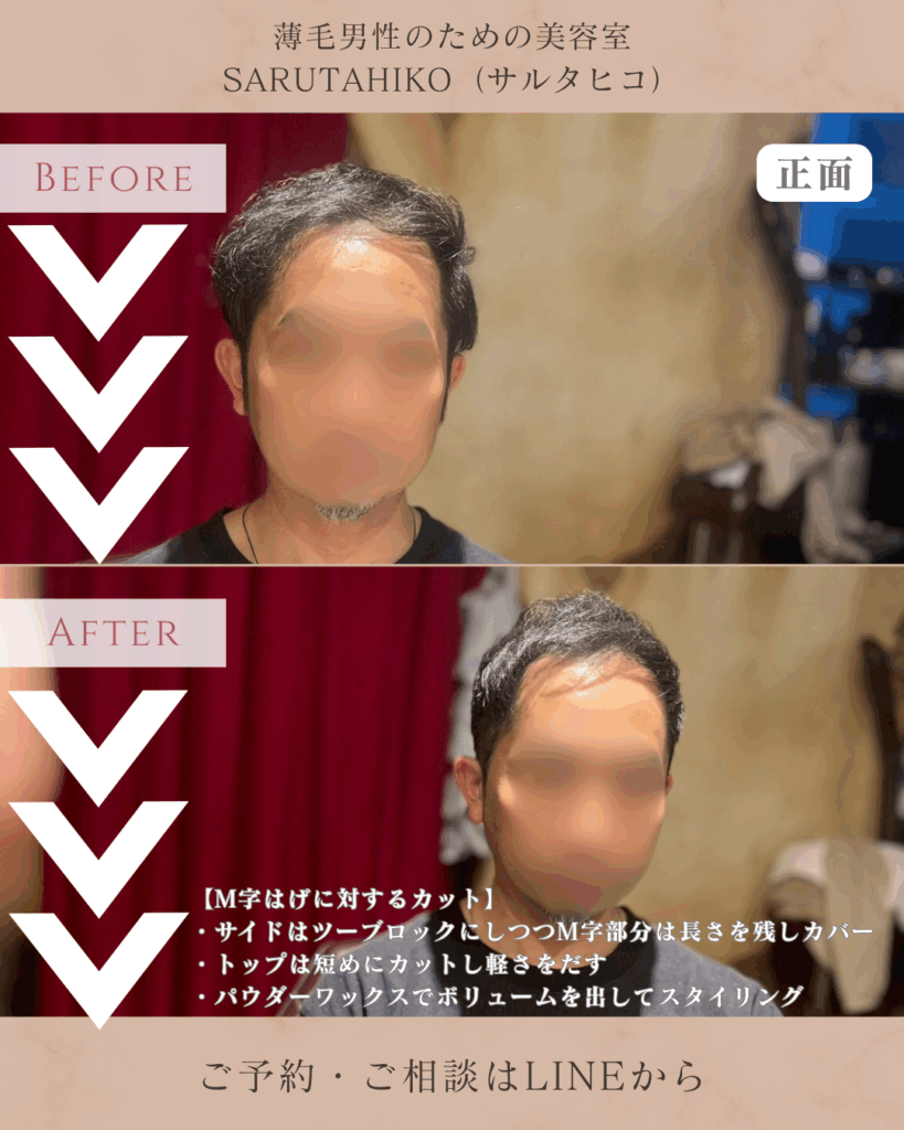 M字はげの薄毛男性のカット前後の写真(正面)