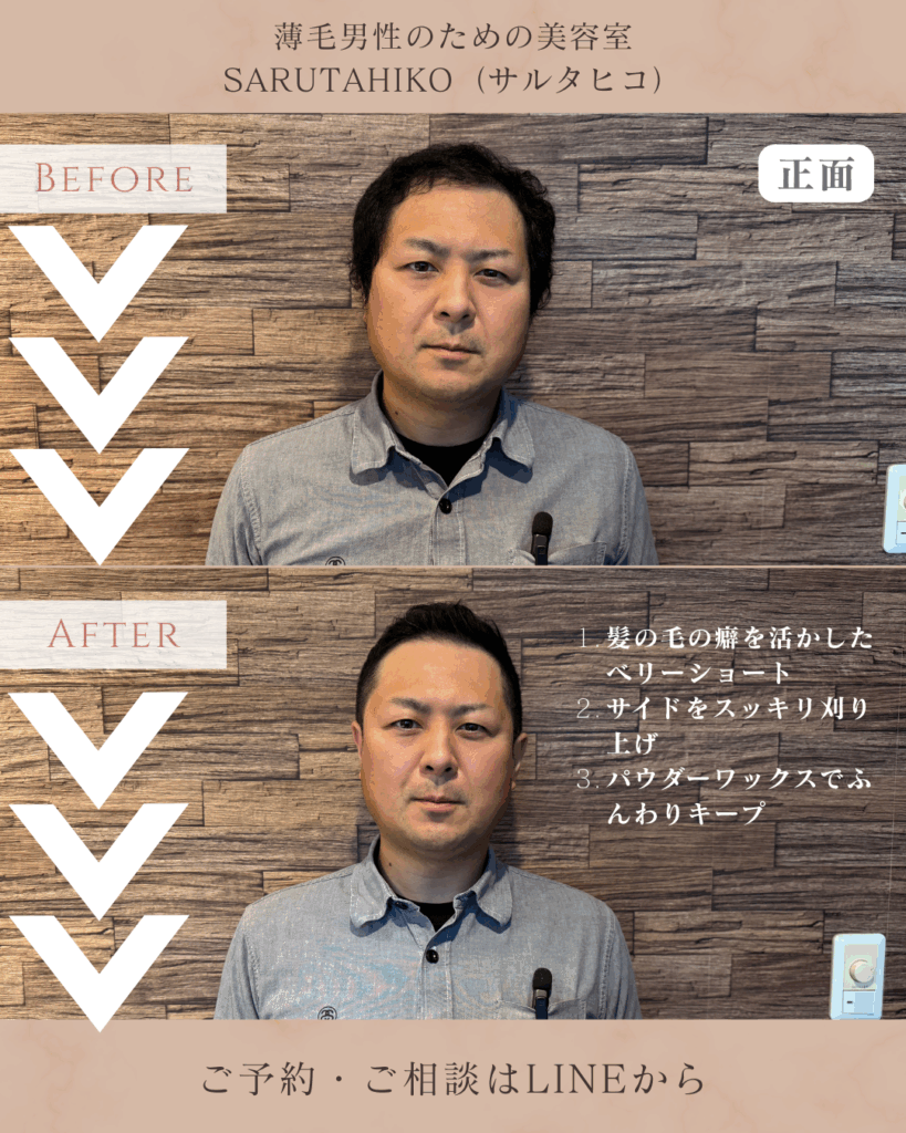 40歳のU字はげの薄毛男性のカット前後の写真(正面)