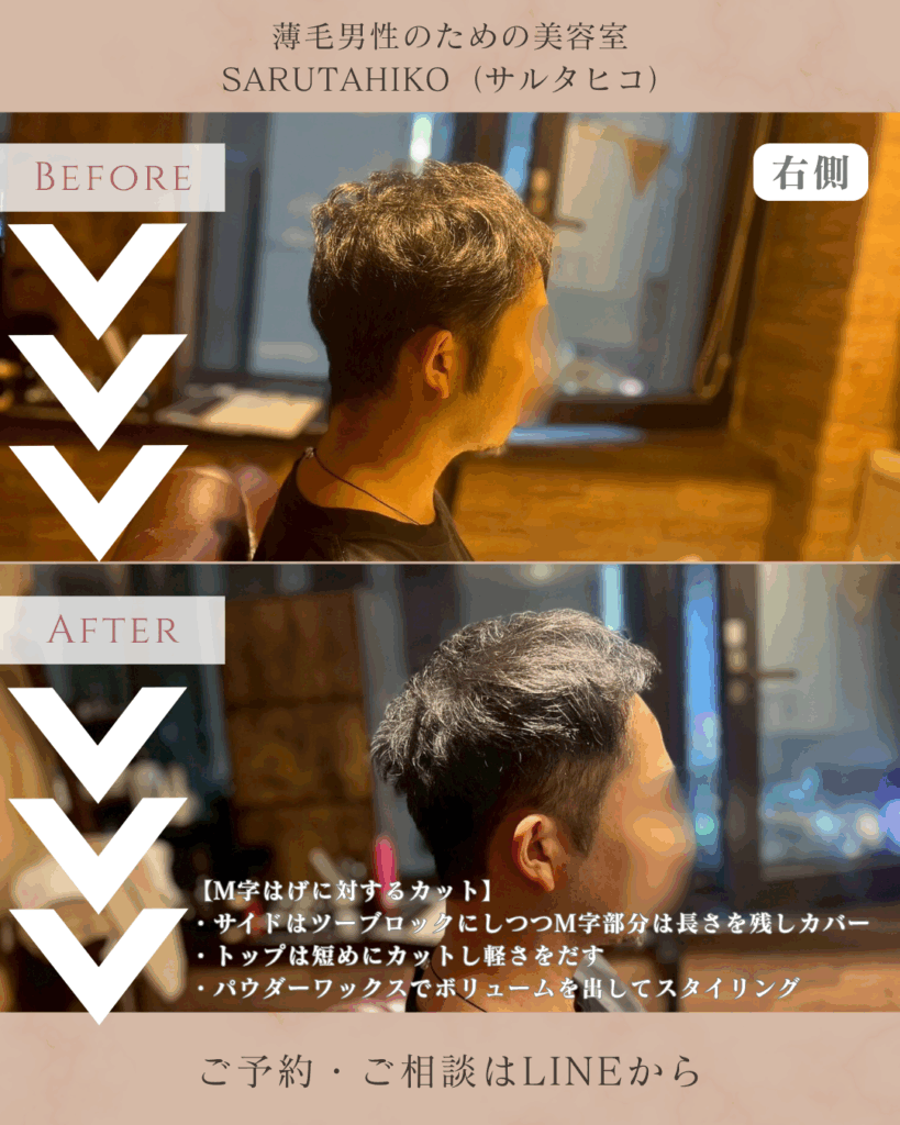 M字はげの薄毛男性のカット前後の写真(右側)
