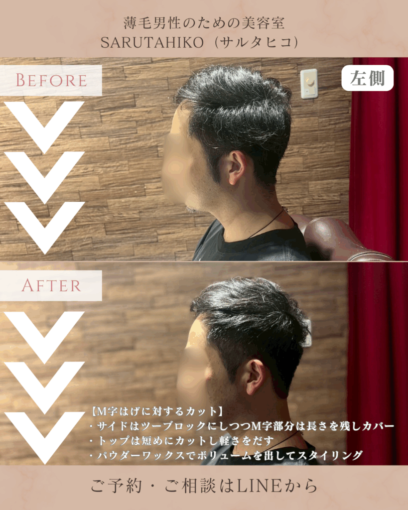 M字はげの薄毛男性のカット前後の写真(左側)