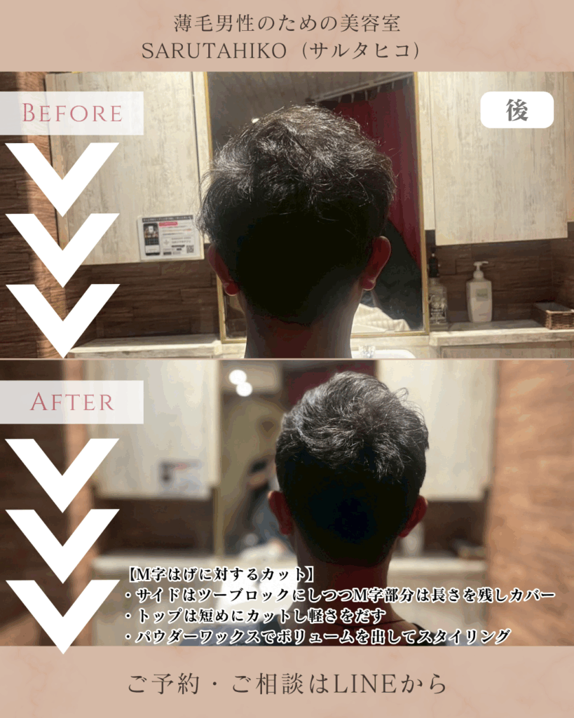 M字はげの薄毛男性のカット前後の写真(後)