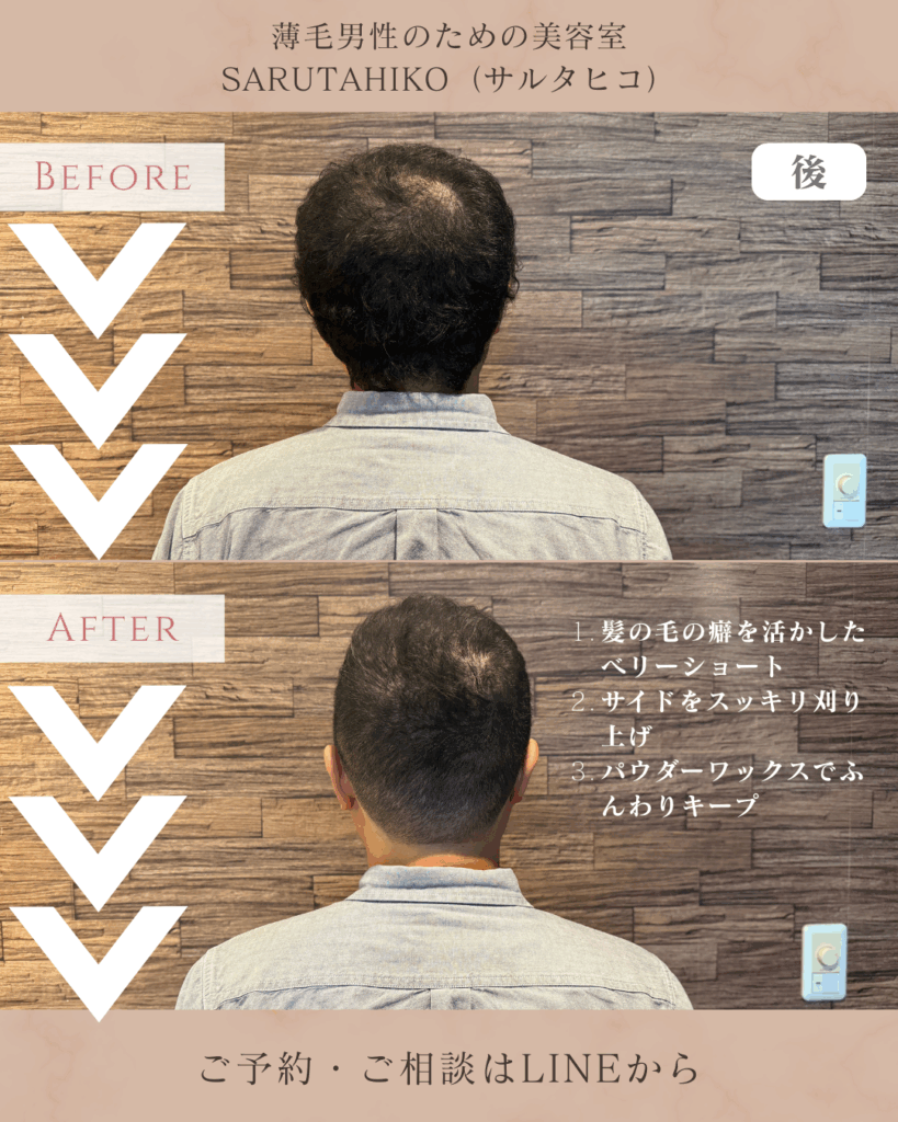 40歳のU字はげの薄毛男性のカット前後の写真(後)