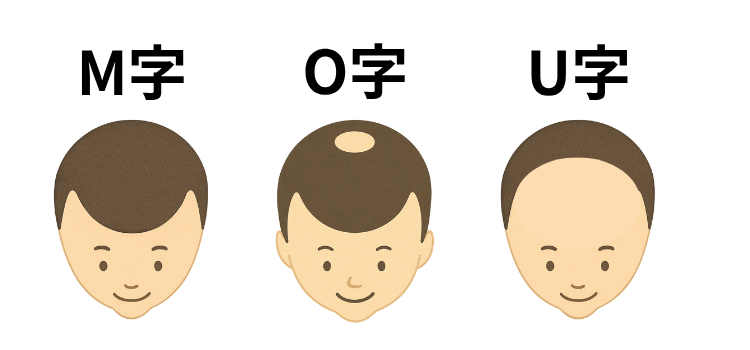 薄毛の種類