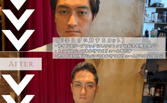 U字ハゲに似合うパーマの髪型_正面