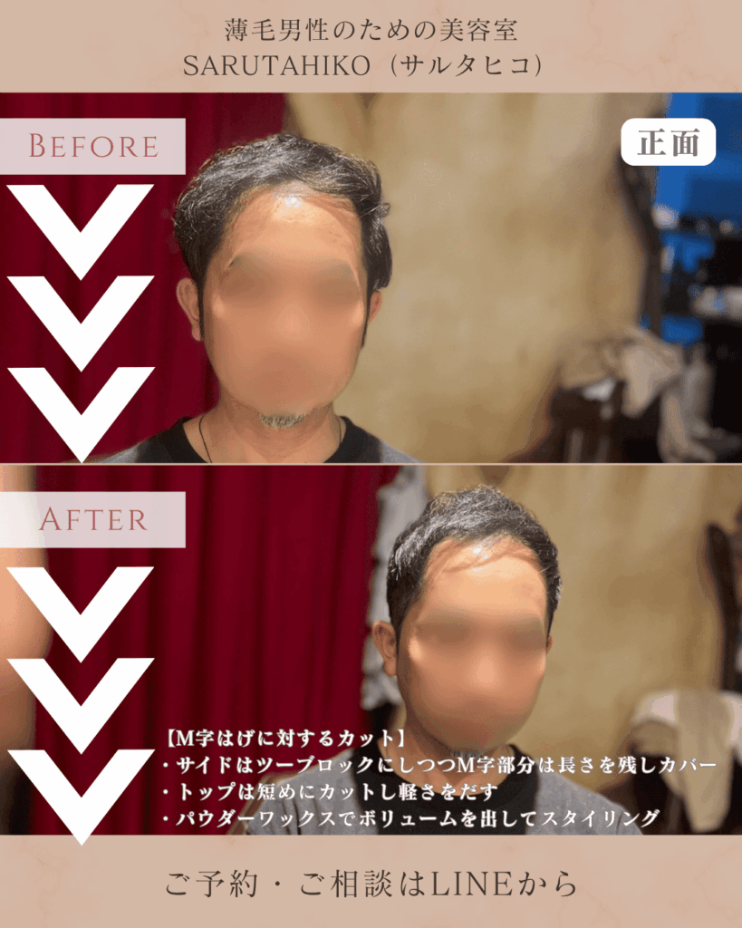 M ツーブロック