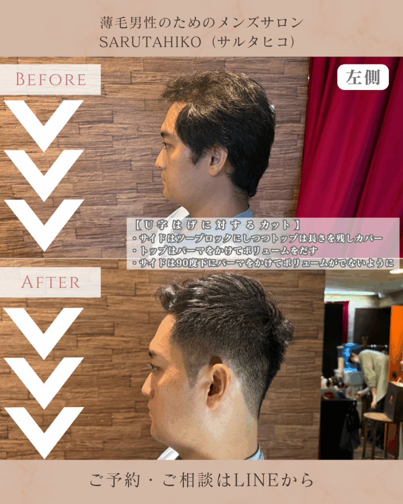 U字ハゲに似合う髪型の左側からの写真_耳周りのスッキリ感がよく分かる