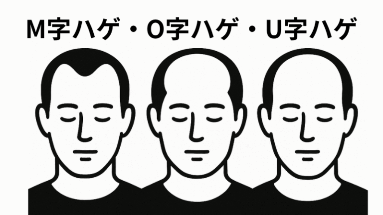 薄毛に似合う髪型【2026最新】プロの理容師が教えるハゲを目立たせない25選