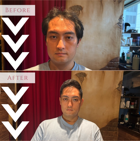 薄毛男性のカットモデルの坪井さん