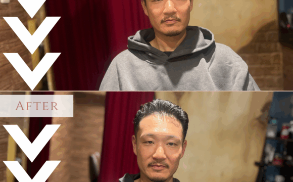 O字薄毛（ハゲ）に対して、極道パーマをご提案