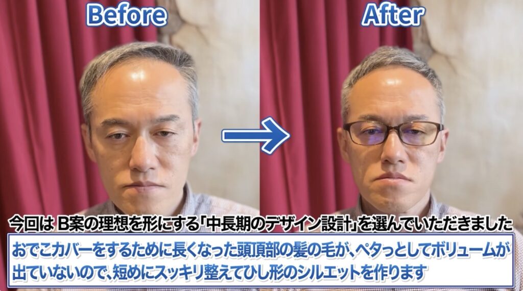 頭頂部の髪の毛を整え、ひし形シルエットを作ります