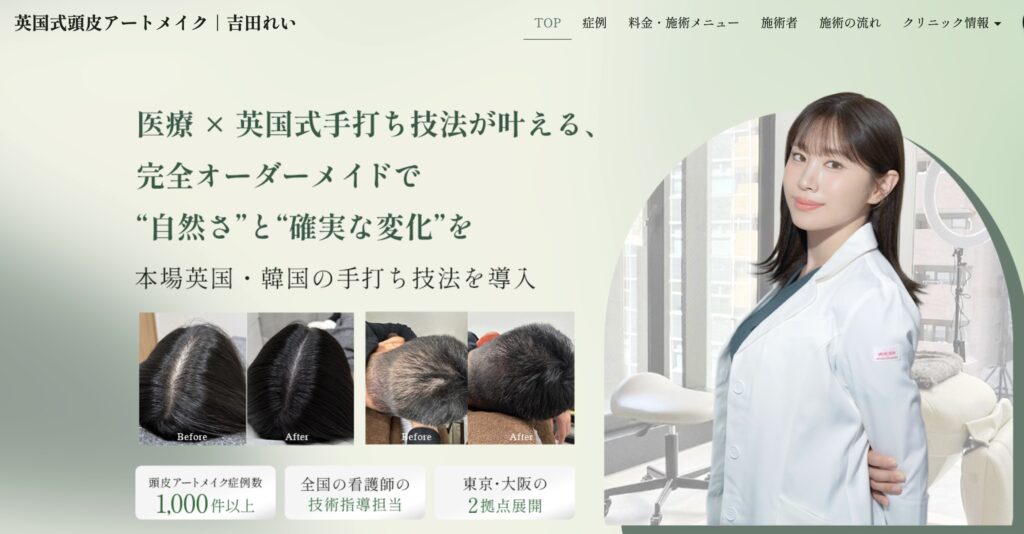 英国式頭皮アートメイク