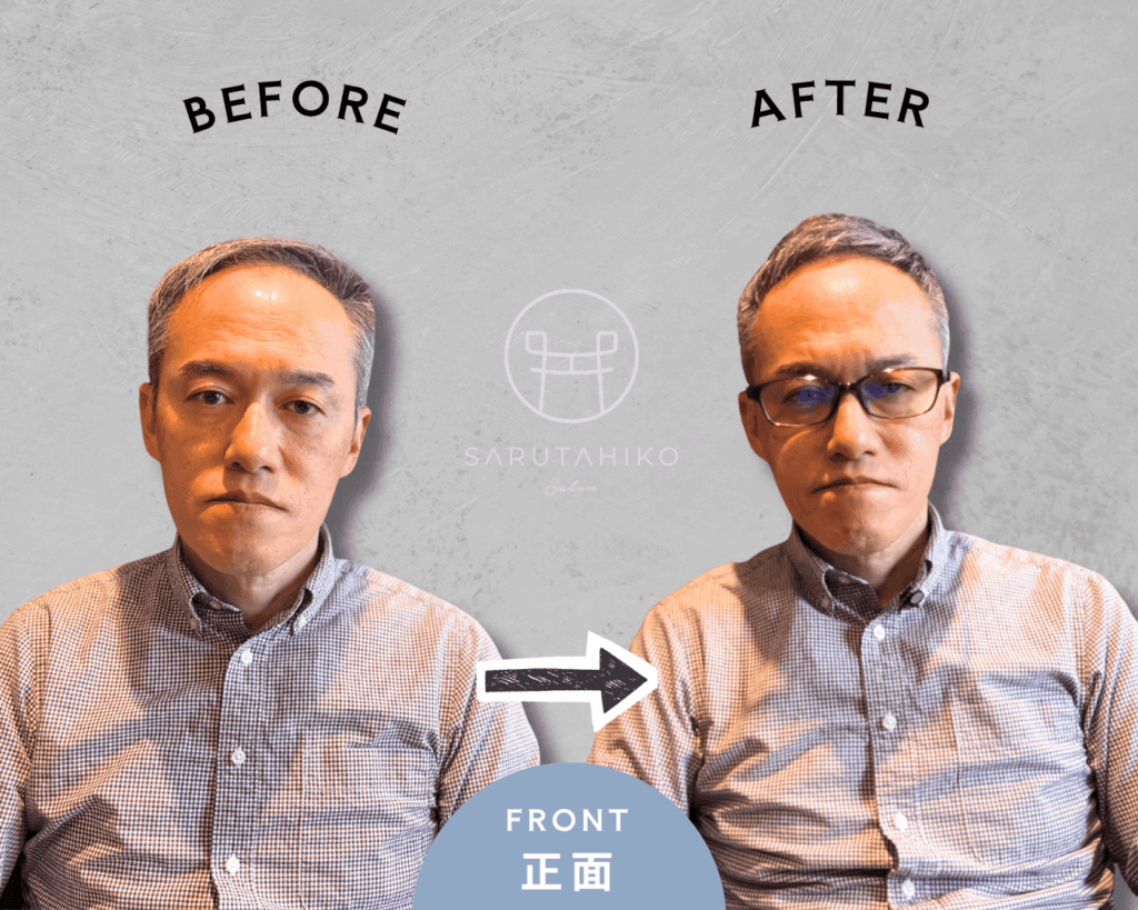 50歳のM字はげの薄毛男性のカット前後の写真(正面)