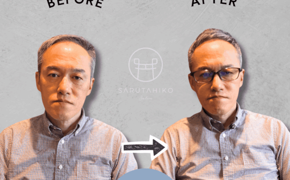 50歳のM字はげの薄毛男性のカット前後の写真（正面）