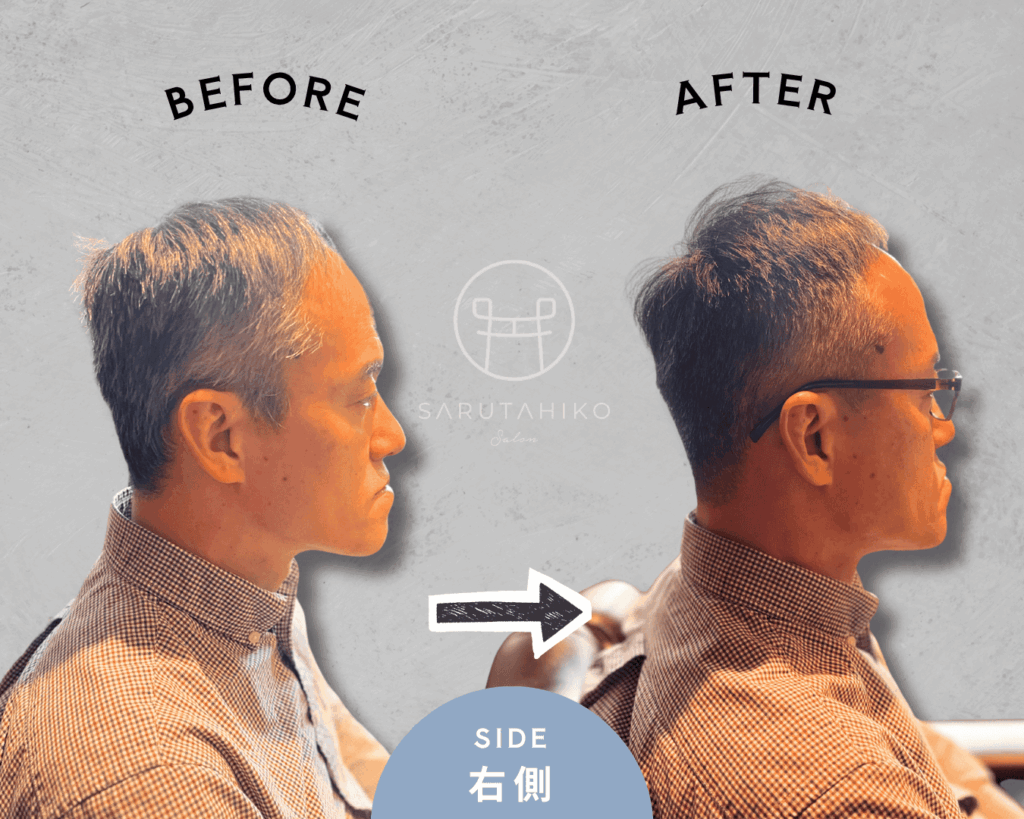 50歳のM字はげの薄毛男性のカット前後の写真(右側)