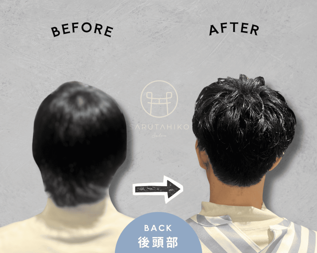 30代の前髪が割れる悩みの薄毛男性のカット前後の写真（後頭部）