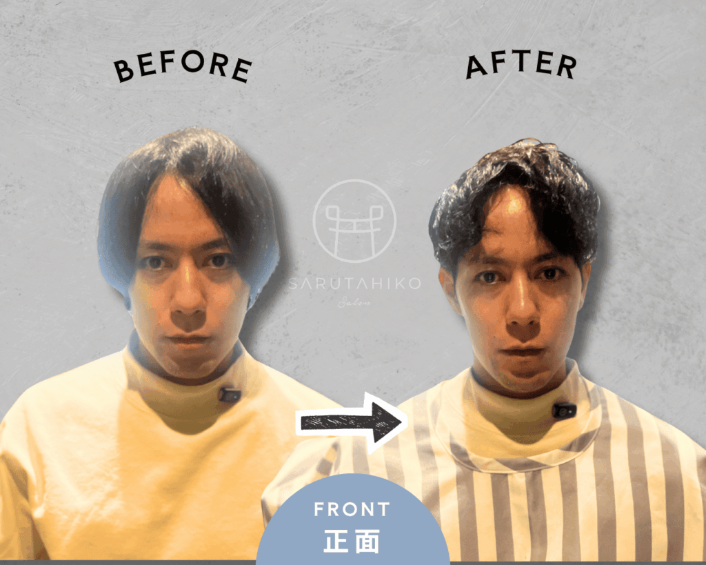 30代の前髪が割れる悩みの薄毛男性のカット前後の写真(正面)