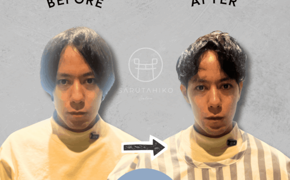 30代の前髪が割れる悩みの薄毛男性のカット前後の写真（正面）
