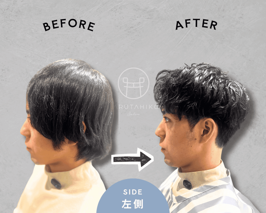 30代の前髪が割れる悩みの薄毛男性のカット前後の写真（左側）