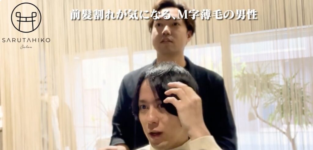 薄毛カウンセリング