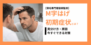 M字はげ初期症状　株式会社SARUTAHIKO 薄毛男性専門の理容室SARUTAHIKO
