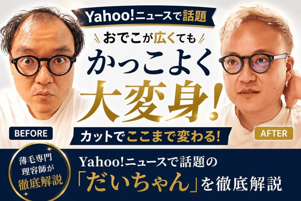 Yahoo!ニュースで話題 だいちゃん徹底解説 株式会社SARUTAHIKO 薄毛男性専門の理容室SARUTAHIKO