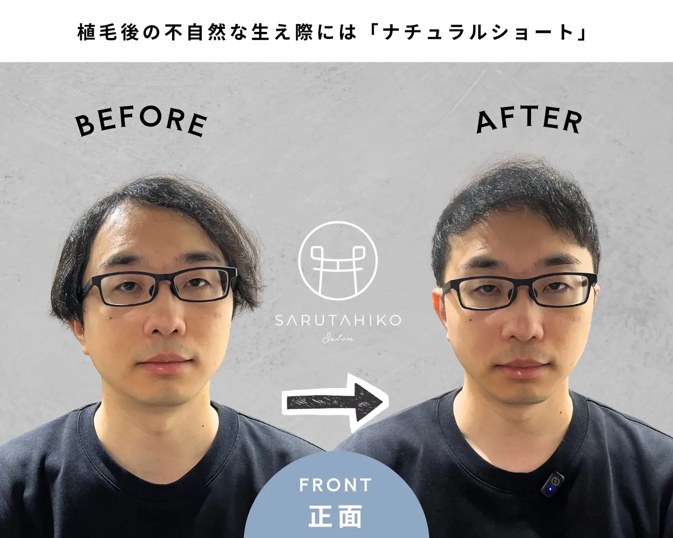 ナチュラルショート 薄毛 髪型 銀座 美容室 SARUTAHIKO