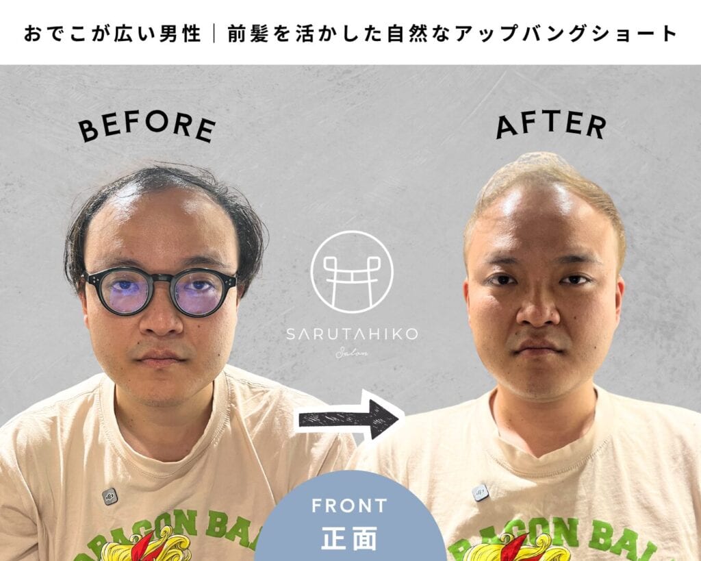トップに動きと立体感を出したショートレイヤー