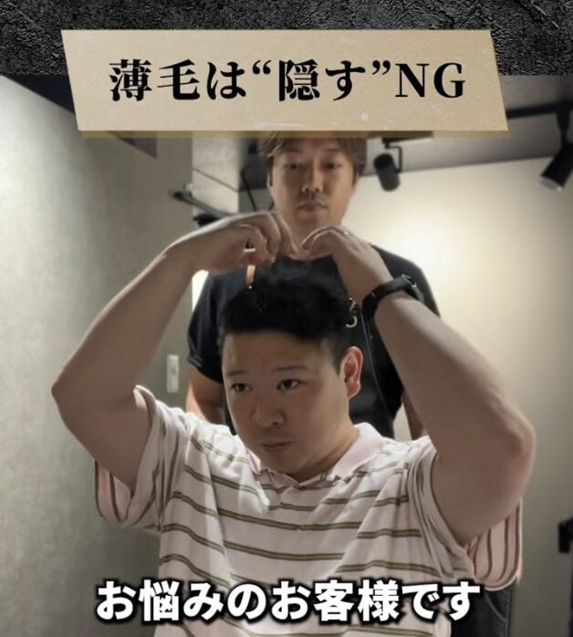 トップのボリュームにお悩みの薄毛男性