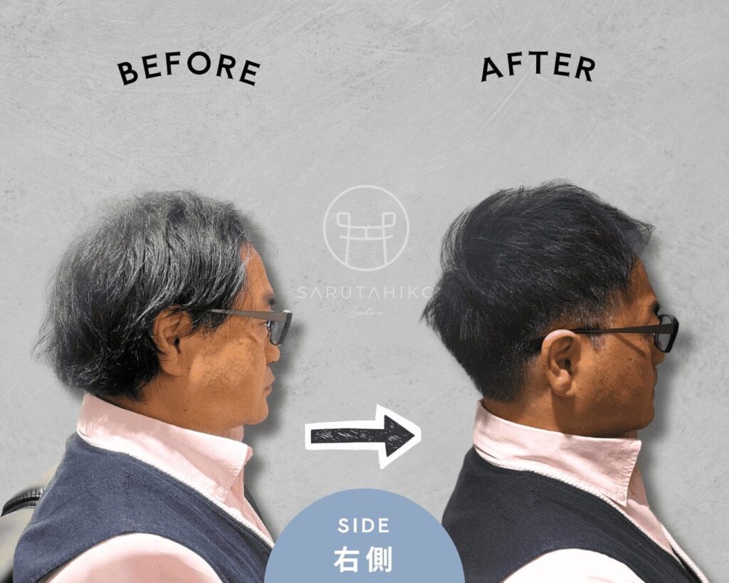 トップのボリュームにお悩みの薄毛男性のカット前後の写真（右横）