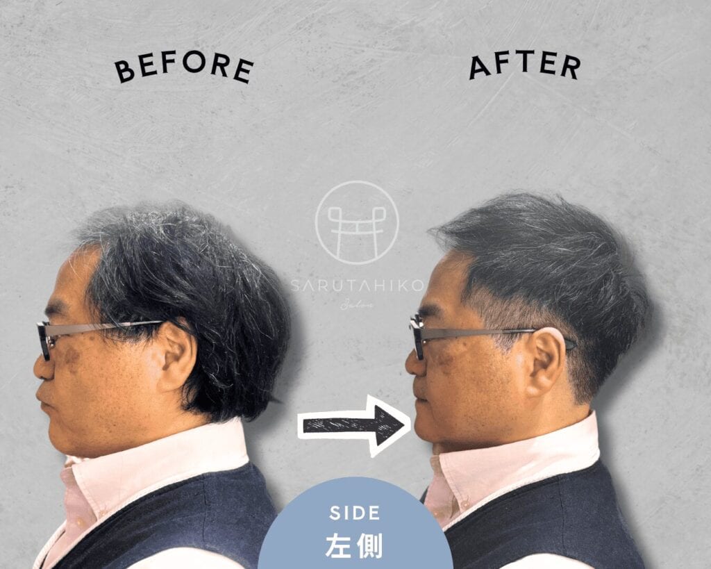 トップのボリュームにお悩みの薄毛男性のカット前後の写真（左横）