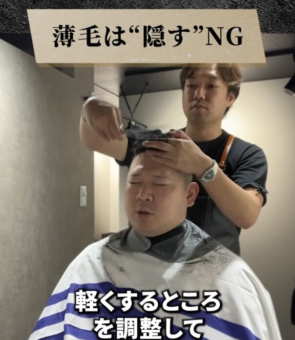 トップのボリュームにお悩みの薄毛男性