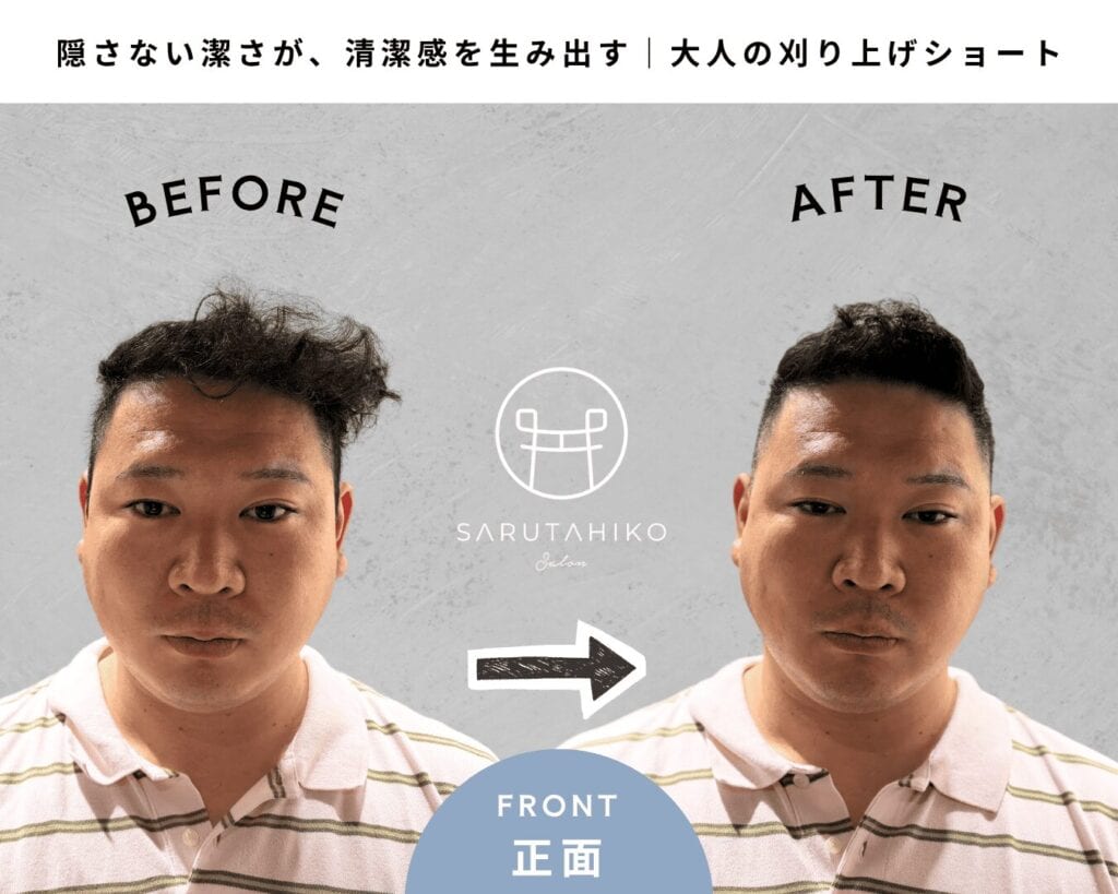 トップのボリュームにお悩みの薄毛男性のカット前後の写真(正面)