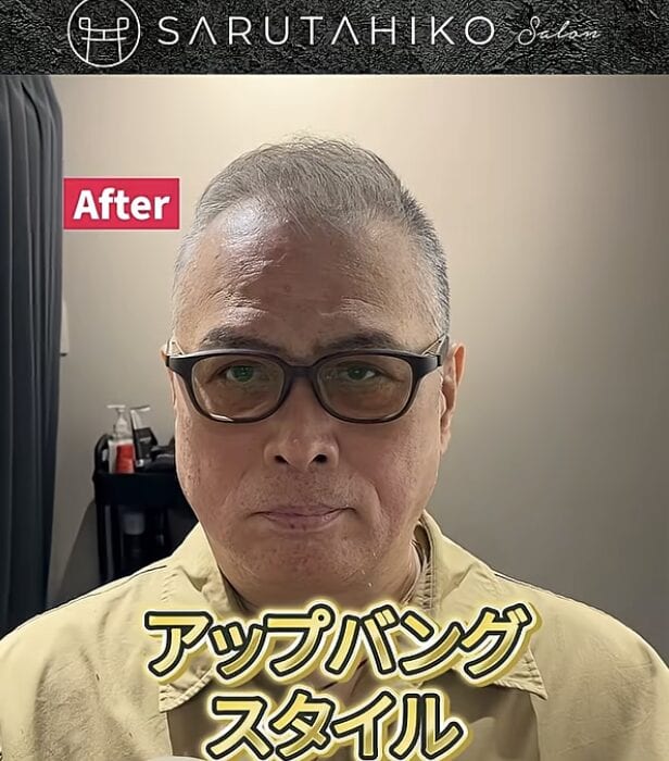 トップのボリュームにお悩みの男性