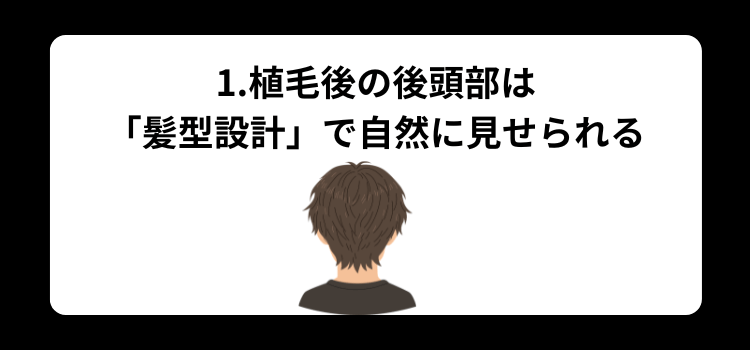 植毛後の後頭部は髪型設計で自然に