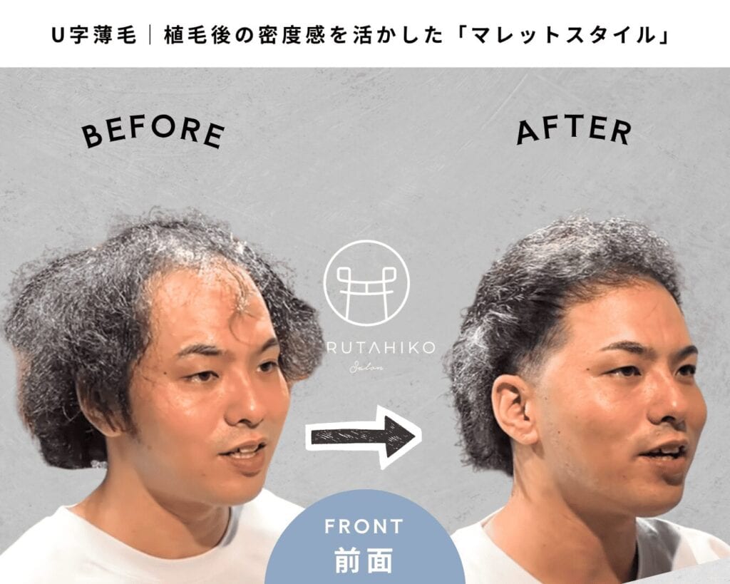 植毛後の密度感を活かしたマレットスタイル