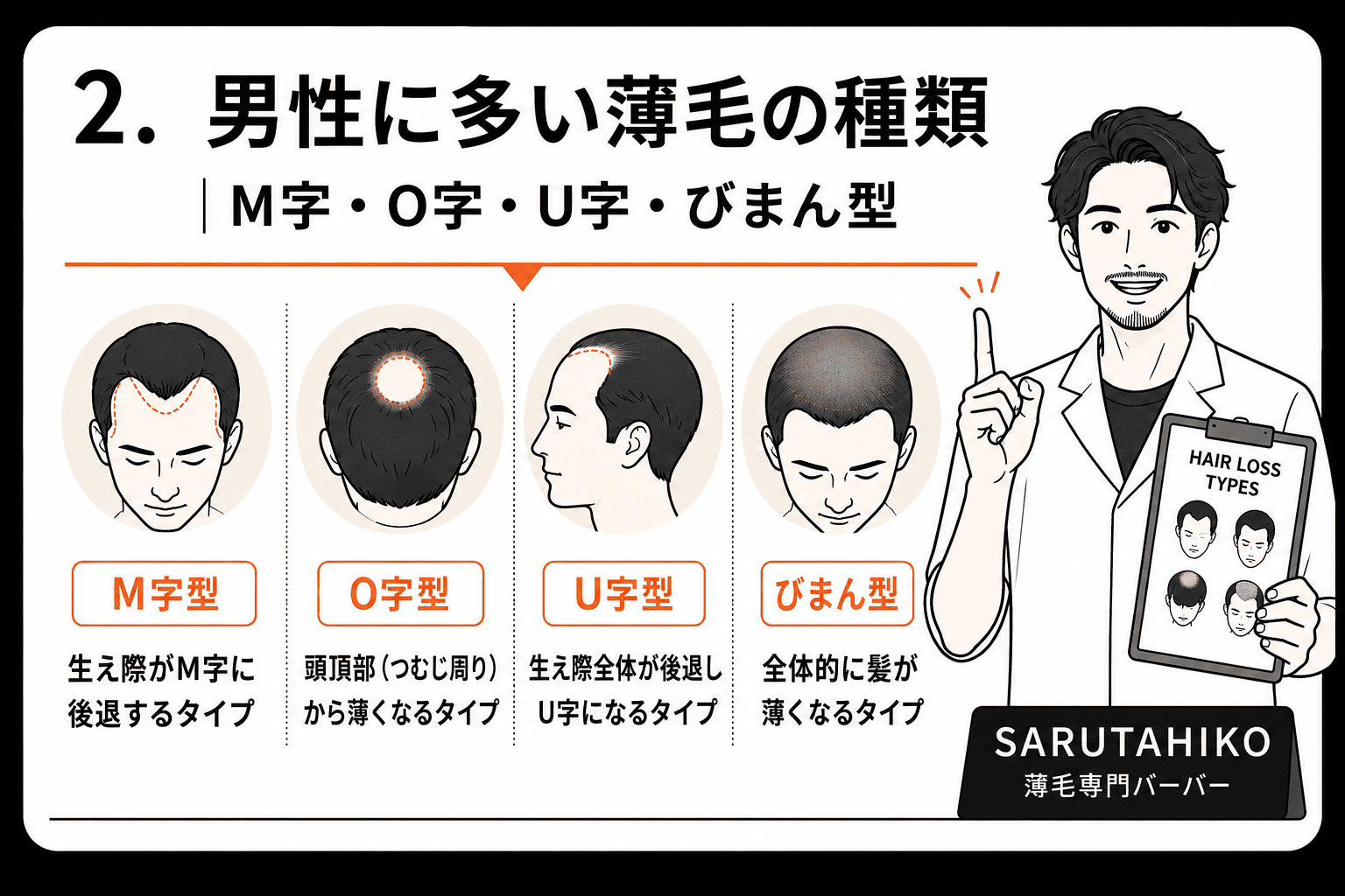 男性に多い薄毛の種類