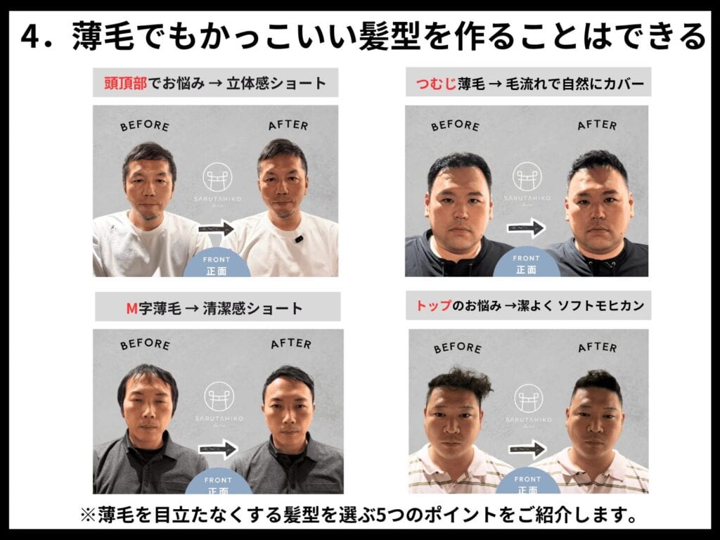 4 薄毛でもかっこいい髪型を作ることはできる