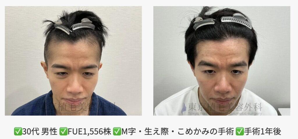 30代男性　症例