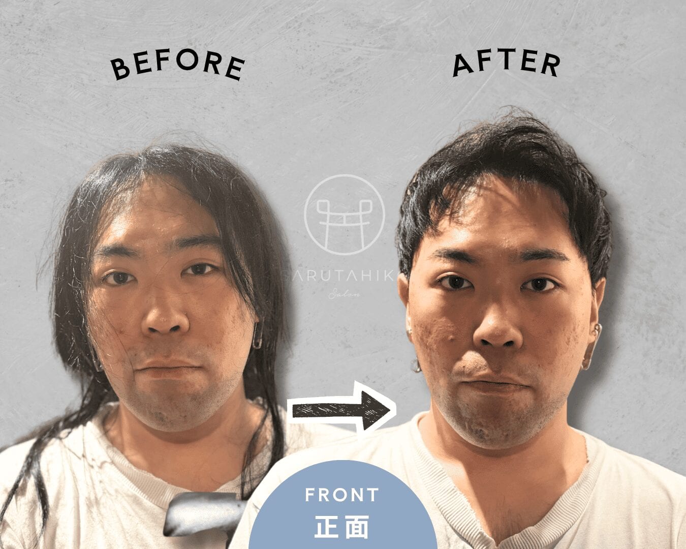 頭頂部薄毛をラフショートで自然にカバーした30代男性のカット前後(正面)