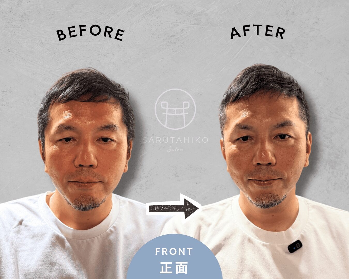 頭頂部・つむじ薄毛を自然にカバーした40代男性のショートヘア正面