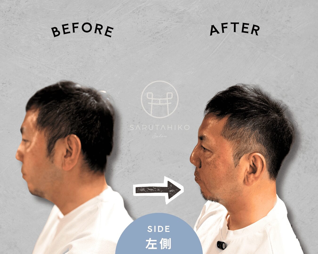 つむじ薄毛を毛流れでカバーした40代男性のショートヘア左側