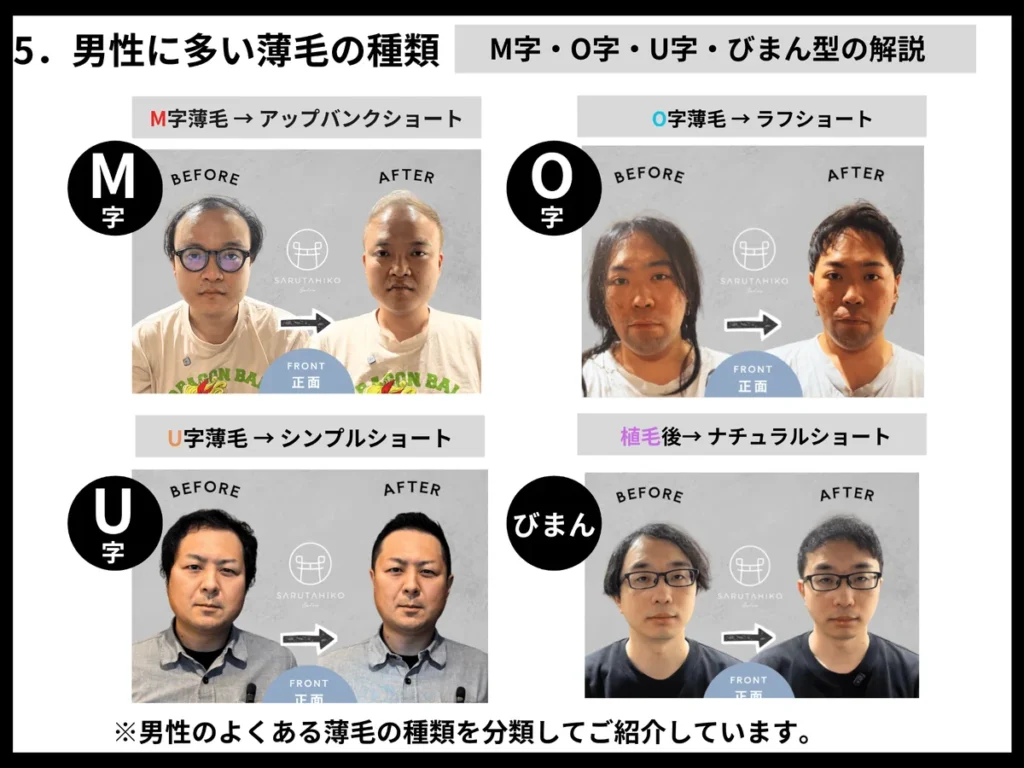 SARUTAHIKO_薄毛タイプ別