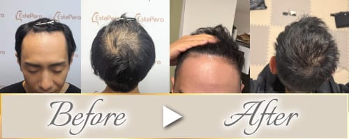 症例Before/After