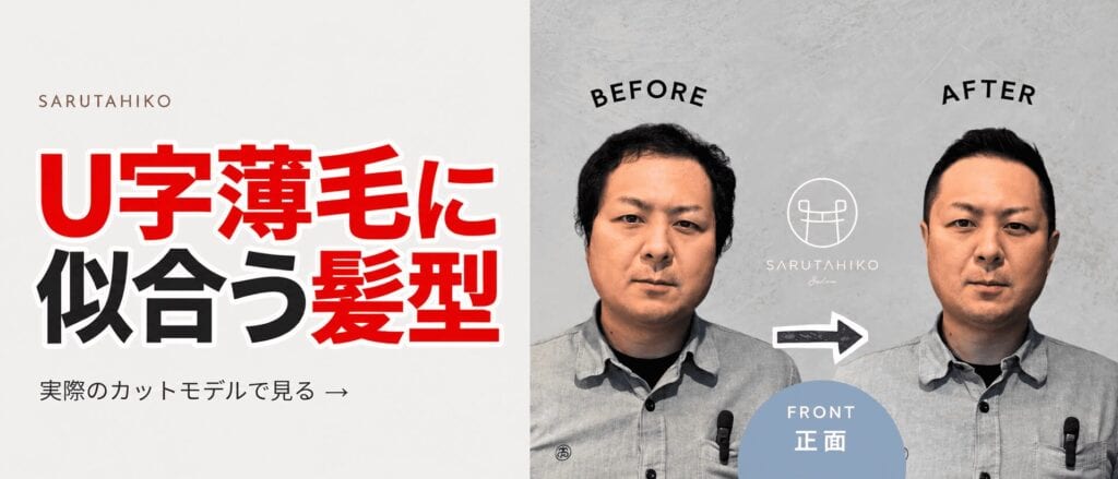 U字薄毛に似合う髪型