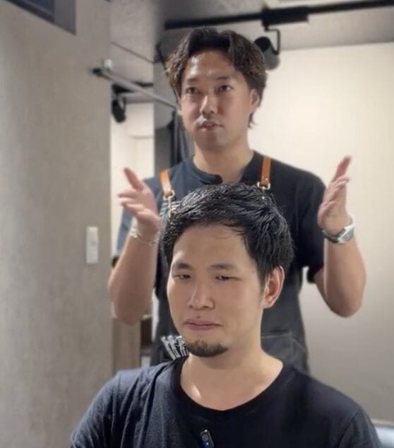 M字薄毛と横の膨らみに悩む30代男性のカウンセリング